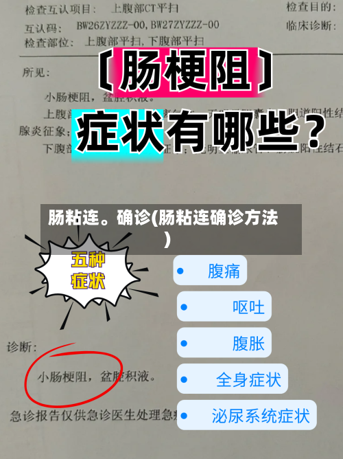 肠粘连	。确诊(肠粘连确诊方法)-第3张图片