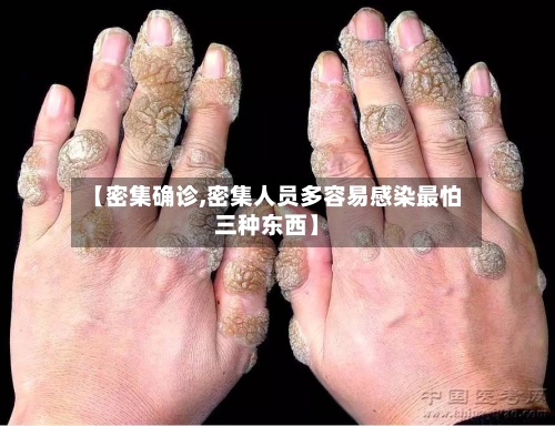 【密集确诊,密集人员多容易感染最怕三种东西】-第2张图片