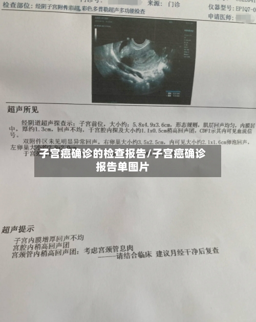 子宫癌确诊的检查报告/子宫癌确诊报告单图片-第3张图片