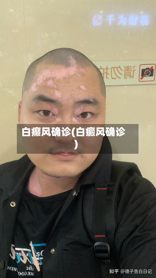 白癫风确诊(白癜风确诊)