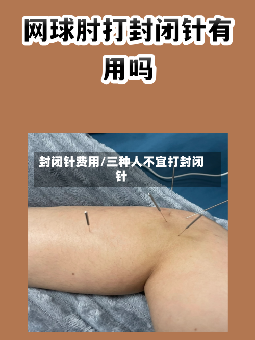 封闭针费用/三种人不宜打封闭针