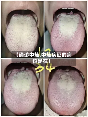 【确诊中焦,中焦病证的病位是在】-第2张图片